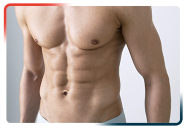 Abdominoplastia Abdominoplastia